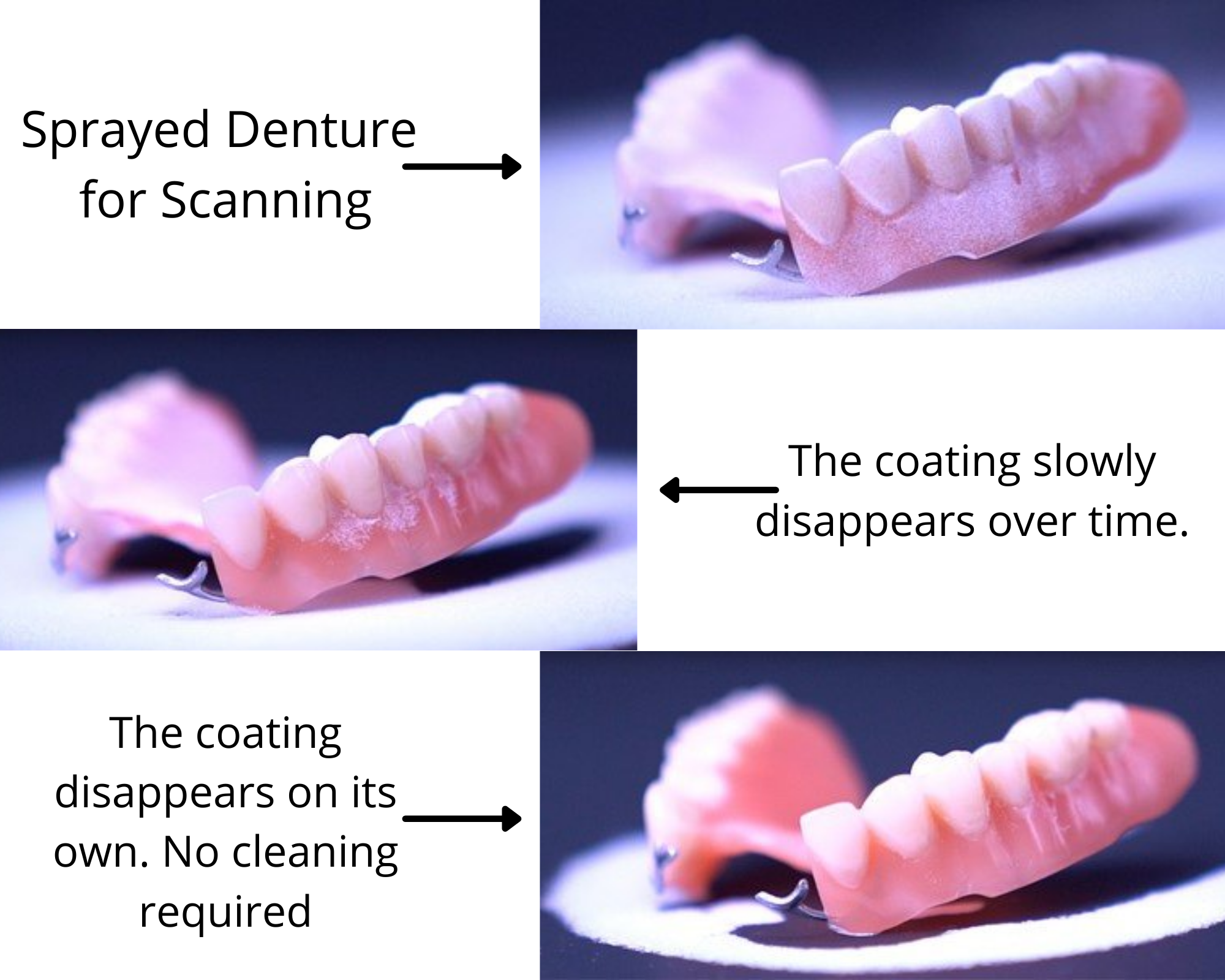 spray denture